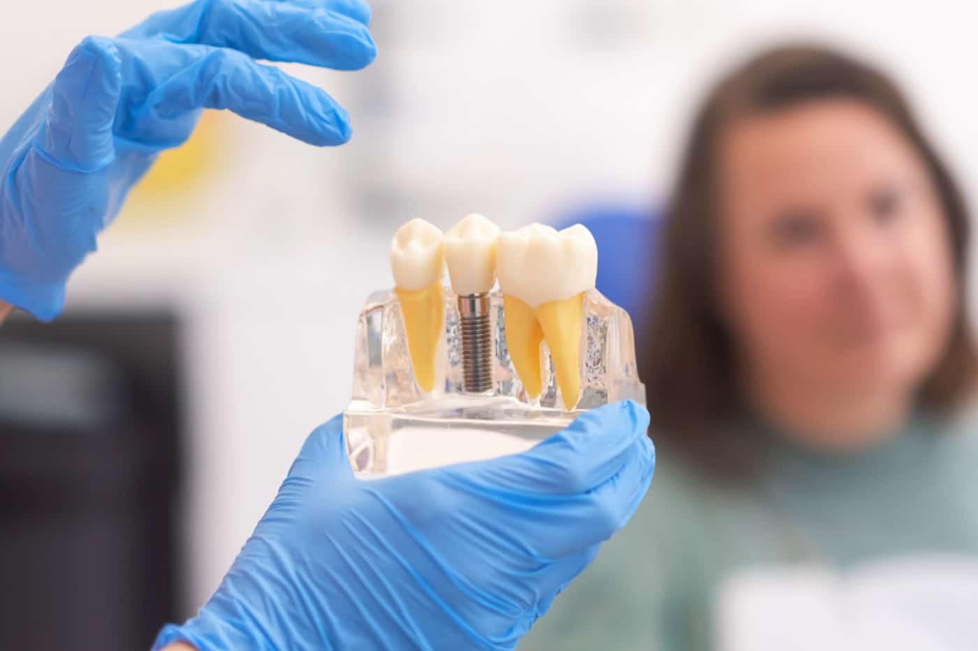 Implant model
